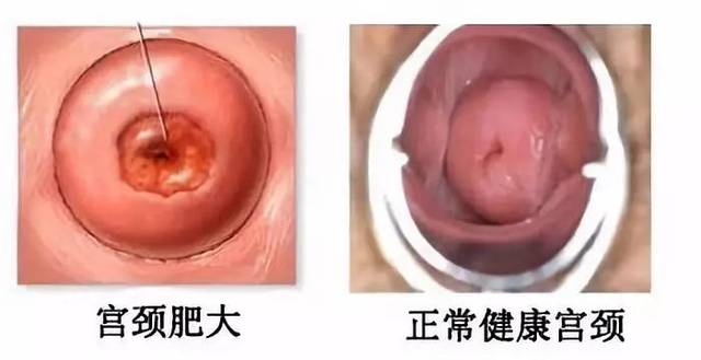 <a href='/gongjingfeida/' target='_blank'><u>ʴ</u></a>