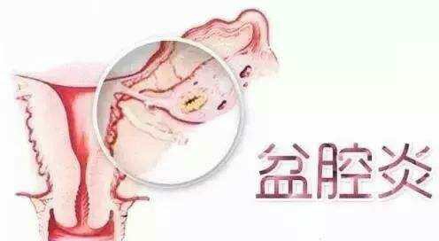 <a href='/penqiangyan/' target='_blank'><u>ǻ</u></a>