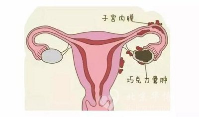 <a href='/qiaokelinanzhong/' target='_blank'><u>ɿ</u></a>Ʒ