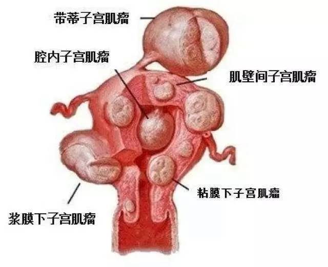 ӹ