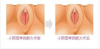 <a href='/yinchunzhengxing/' target='_blank'><u></u></a>