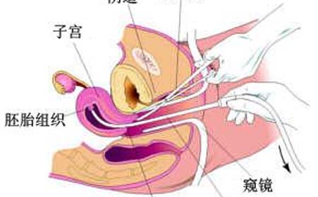 ʹ<a href='/renliu/' target='_blank'><u></u></a>۸