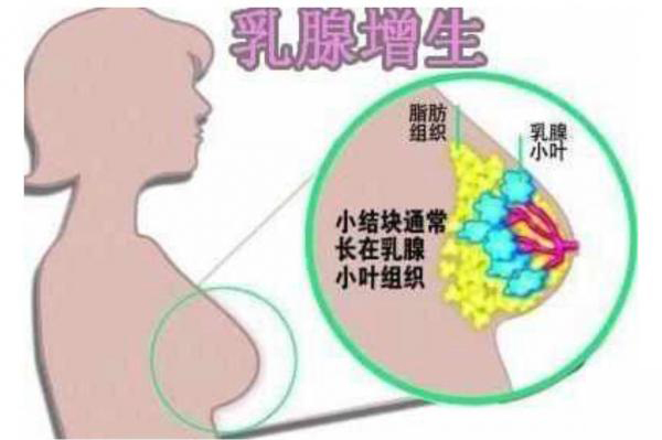 <a href='/ruxianzengsheng/' target='_blank'><u></u></a>Ĳ
