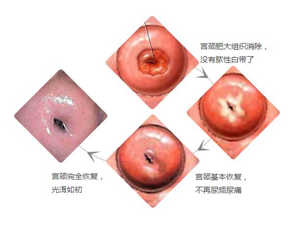 <a href='/gongjingfeida/' target='_blank'><u>ʴ</u></a>֢״