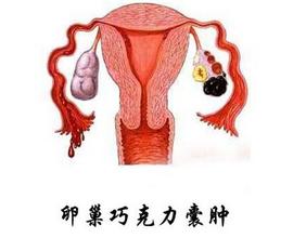 <a href='/qiaokelinanzhong/' target='_blank'><u>ɿ</u></a>Σ