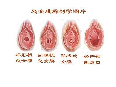 <a href='/chunvmoxiufu/' target='_blank'><u>ŮĤ޸</u></a>