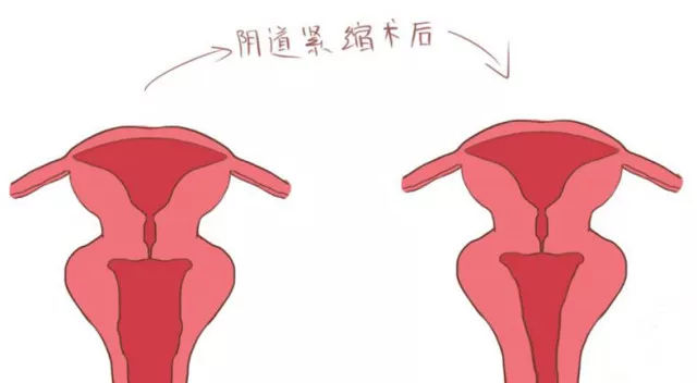 <a href='/yindaojinsuo/' target='_blank'><u></u></a>