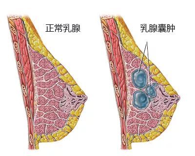 <a href='/ruxiannanzhong/' target='_blank'><u></u></a>