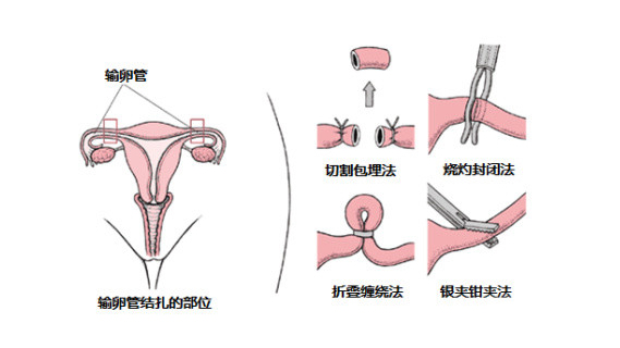 <a href='/shuluanguanjiezha/' target='_blank'><u>ѹܽ</u></a>