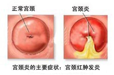 <a href='/gongjingyan/' target='_blank'><u></u></a>֢״