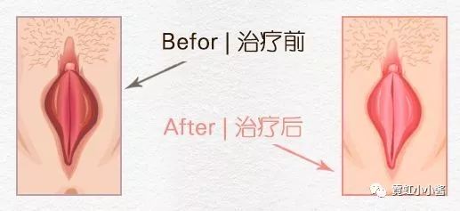 <a href='/yindaojinsuo/' target='_blank'><u></u></a>