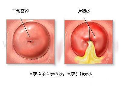 <a href='/gongjingyan/' target='_blank'><u></u></a>