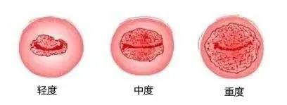 <a href='/gongjingmilan/' target='_blank'><u></u></a>
