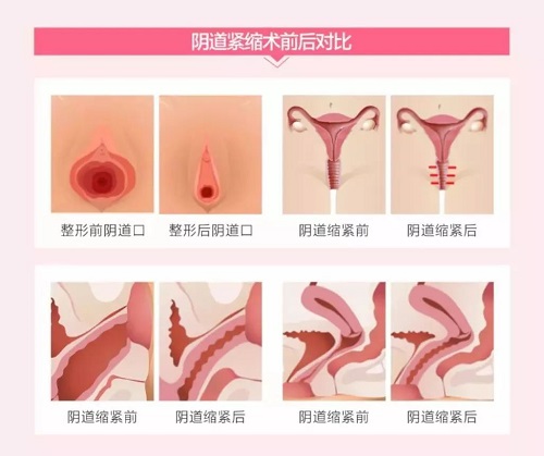 <a href='/yindaojinsuo/' target='_blank'><u></u></a>