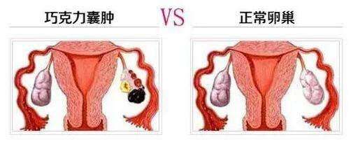 <a href='/qiaokelinanzhong/' target='_blank'><u>ɿ</u></a>
