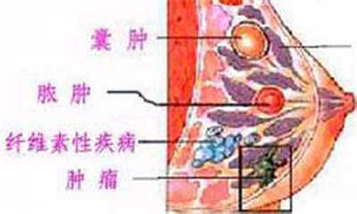 <a href='/ruxiannanzhong/' target='_blank'><u></u></a>