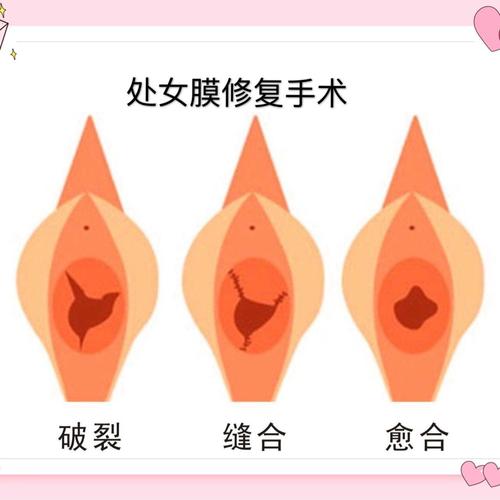 <a href='/chunvmoxiufu/' target='_blank'><u>ŮĤ޸</u></a>