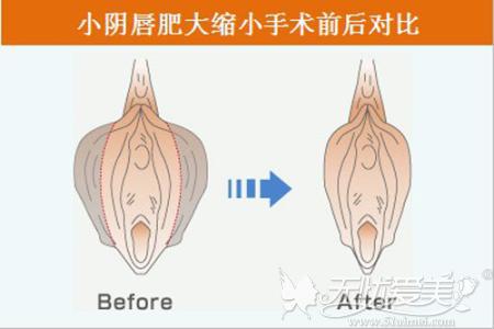 С<a href='/yinchunzhengxing/' target='_blank'><u></u></a>