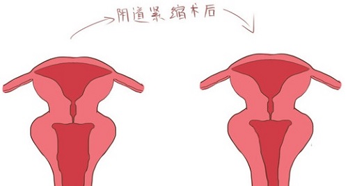 <a href='/yindaojinsuo/' target='_blank'><u></u></a>