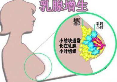 <a href='/ruxianzengsheng/' target='_blank'><u></u></a>
