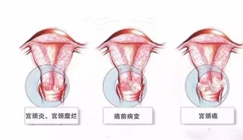 <a href='/gongjingyan/' target='_blank'><u></u></a>