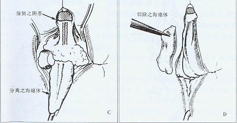 <a href='/yindizhengxing/' target='_blank'><u></u></a>