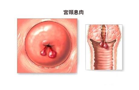 <a href='/gongjingxirou/' target='_blank'><u>Ϣ</u></a>