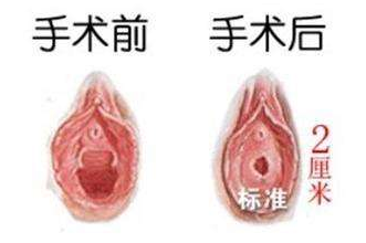 <a href='/chunvmoxiufu/' target='_blank'><u>ŮĤ޸</u></a>