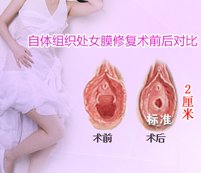 <a href='/chunvmoxiufu/' target='_blank'><u>ŮĤ޸</u></a>