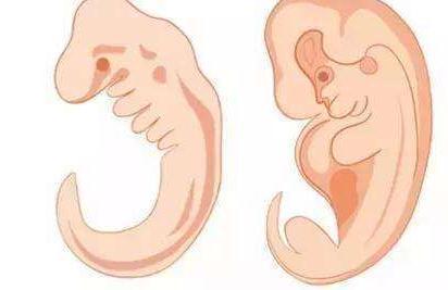 胎心胎芽