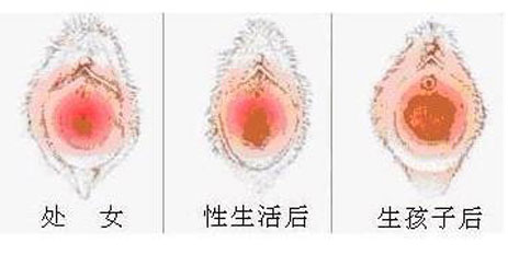 <a href='/chunvmoxiufu/' target='_blank'><u>ŮĤ޸</u></a>