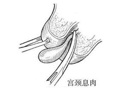 <a href='/gongjingxirou/' target='_blank'><u>Ϣ</u></a>Ʒ