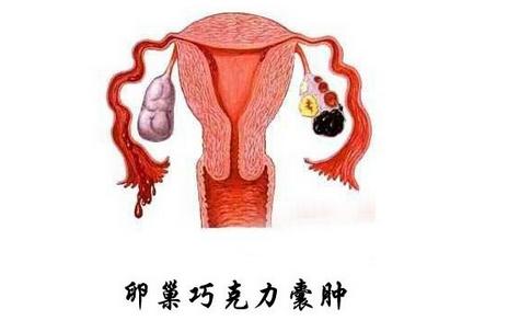 <a href='/qiaokelinanzhong/' target='_blank'><u>ɿ</u></a>ôԤ